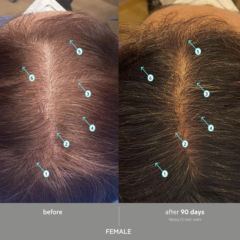 SPECTRAL EXTRA STRENGTH® | 7% Nanoxidil + 3 DHT Inhibitors Serum