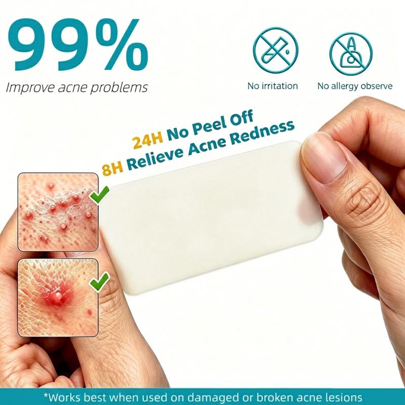 Dimora Medical-Grade Hydrocolloid Acne Patch, Acne spot treatment, Cuttable Overnight Pimple Patch, Acne Mark Fading Patch, Large Size Roll (2 in × 16 ft), Suitable for Acne, Open Wounds, and Sensitive Skin
