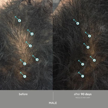 SPECTRAL EXTRA STRENGTH® | 7% Nanoxidil + 3 DHT Inhibitors Serum