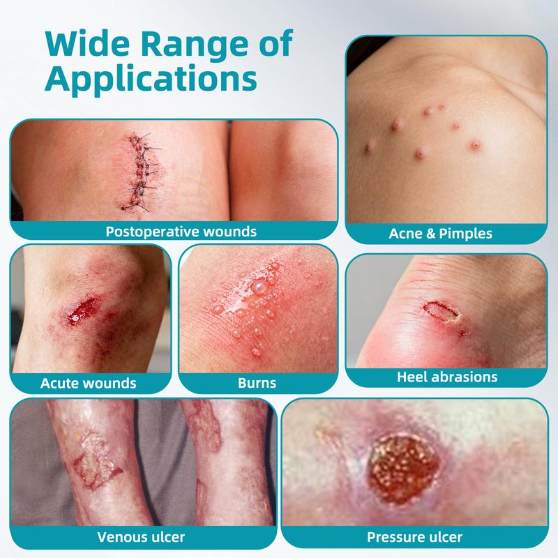 Dimora Medical-Grade Hydrocolloid Acne Patch, Acne spot treatment, Cuttable Overnight Pimple Patch, Acne Mark Fading Patch, Large Size Roll (2 in × 16 ft), Suitable for Acne, Open Wounds, and Sensitive Skin