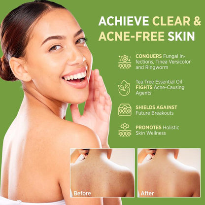 DetoxViva Tea Tree Antifungal Soap Bar